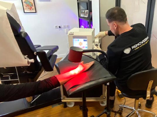 Persona realizando el láser para eliminar tatuajes en uno de nuestros clientes